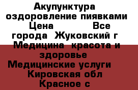 Акупунктура, оздоровление пиявками › Цена ­ 3 000 - Все города, Жуковский г. Медицина, красота и здоровье » Медицинские услуги   . Кировская обл.,Красное с.